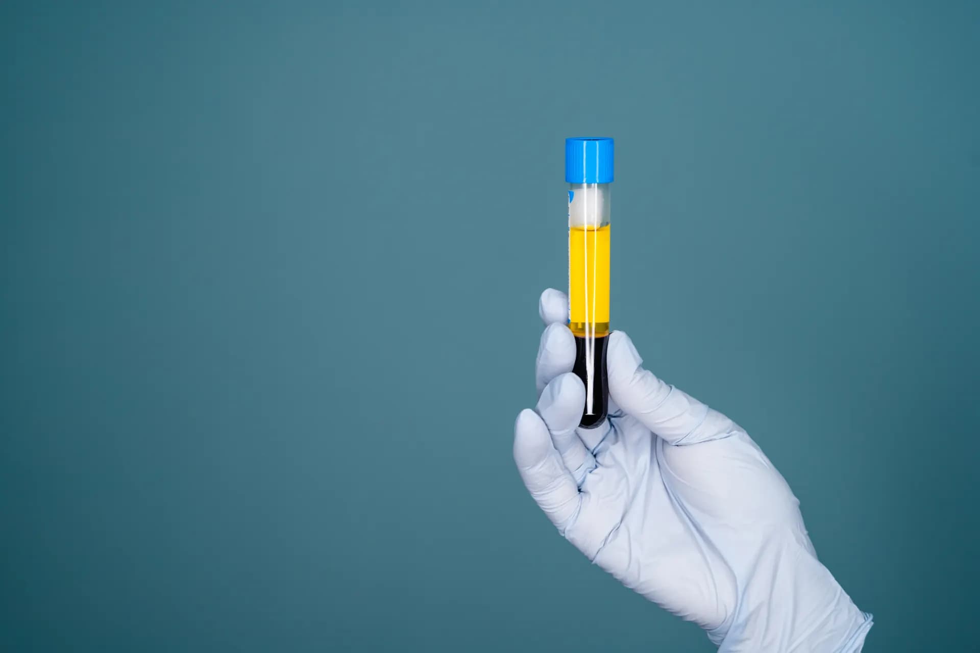 Platelet-Rich Fibrin Matrix image