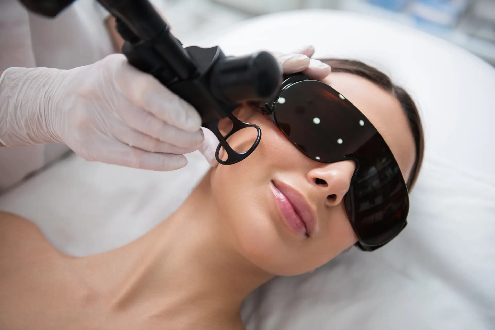Laser Skin Resurfacing image